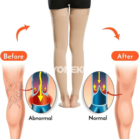 Dyzdan ýokary kompression joraplar, açyk barmakly, 30-40 mmHg